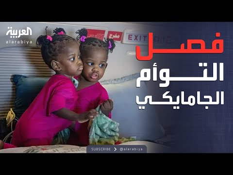 فيديو | الرابعة | السعودية تفصل توأمًا جامايكيًا.. إنجاز طبي جديد يسجل للرياض