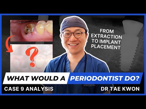 What Would A Periodontist Do? With Dr Tae Kwon - Case 9