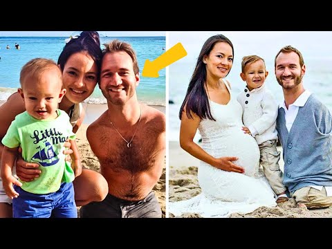 Diese Frau hat einen Mann geheiratet, der ohne Arme und Beine geboren wurde...