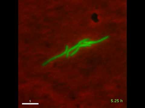 Timelapse microscopy of bacteria growing in a microfluidic device