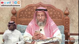 345 - تركيب شعر صناعي في حال تساقط الشعر - عثمان الخميس