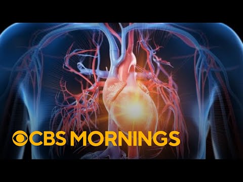 Heart attack warning signs and symptoms women should not ignore