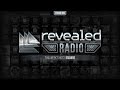 Revealed Radio 059 - Hosted by eSQUIRE 