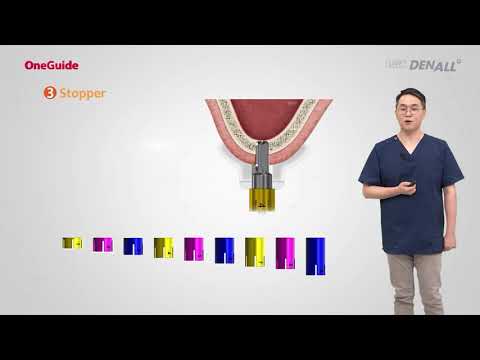 OneGuide - Ep 4. OneCAS System Understanding and Clinical Application