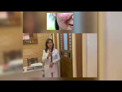 KELOID FORMATION O KELOID SCAR PUWEDE NA YAN MAWALA