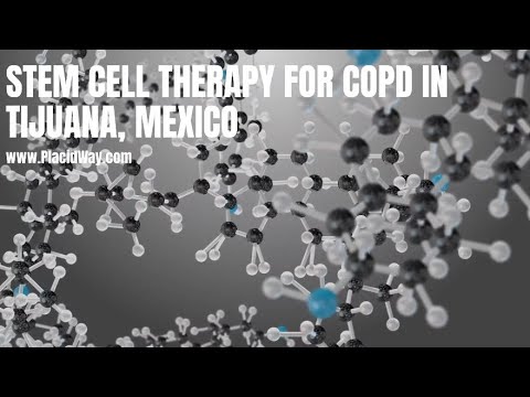 Stem Cell Therapy for COPD in Tijuana, Mexico
