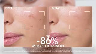 Ανακαλύψτε τον νέο ορό | Vichy Greece