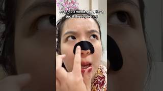 Download lagu MARI KITA FANEN SINGKONG LAGI!! 🤩 #shorts #itsmeissie #blackheads mp3 Download lagu MARI KITA FANEN SINGKONG LAGI!! 🤩 #shorts #itsmeissie #blackheads mp3