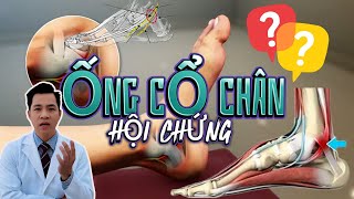 HỘI CHỨNG ỐNG CỔ CHÂN | LÀM SAO ĐỂ NHẬN BIẾT ? | BS NGUYỄN MINH TẤN
