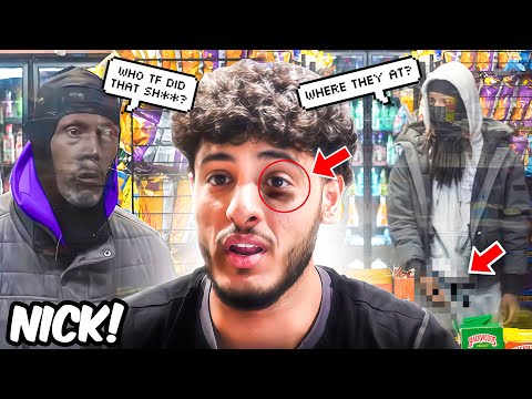 BLACK EYE IN THE HOOD COMPILATION -KHALID ATTAF