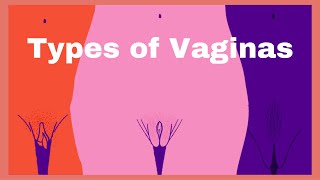 Types of Vaginas shapes and sizes Normal or abnorm