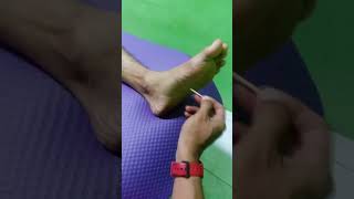 Download lagu cheking telapak kaki akibat cedera dengan tusuk gigi mp3