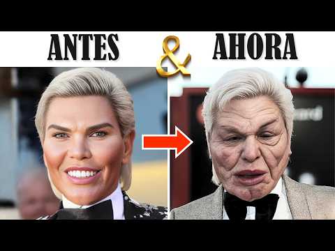 Introducción Cirugías Hollywood