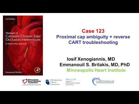 Case 123: Manual of CTO Interventions: Proximal cap ambiguity + reverse CART troubleshooting