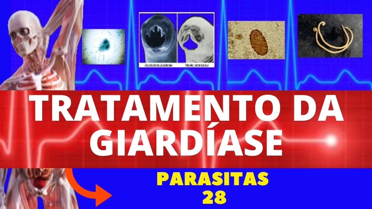 TRATAMENTO PARA GIARDÍASE (GIARDIA LAMBLIA) - COMO RESOLVER A GIARDÍASE - PARASITOLOGIA|INFECTOLOGIA