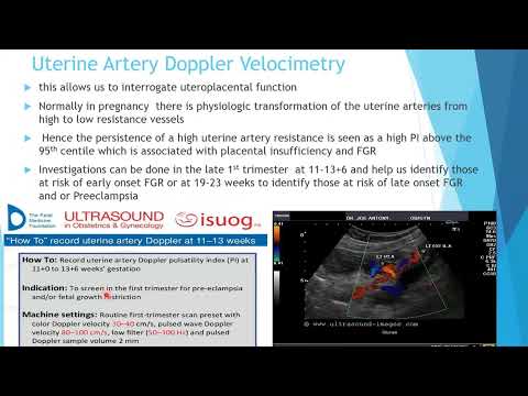 Fetal Growth Restriction, Diagnosis and Management- Dr L  Hlatywayo