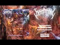 DYSMORFECTOMY DISEMBODIED ANOMALIES Full Album 2018