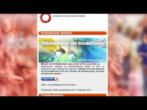 Hjärtklappning behandling