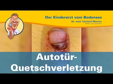 Differential der Diagnostik die Schuppenflechte und mikrobnaja das Ekzem Der Rat des Dermatologen von der Schuppenflechte