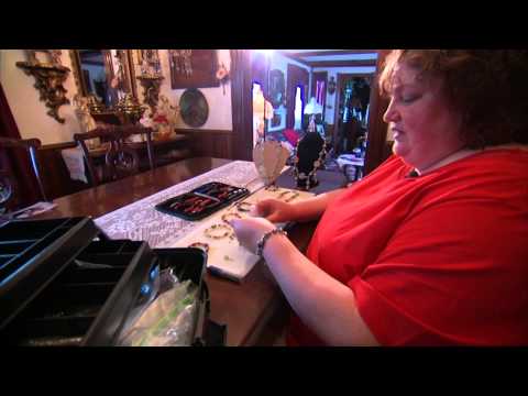 Living with Lupus - Mayo Clinic