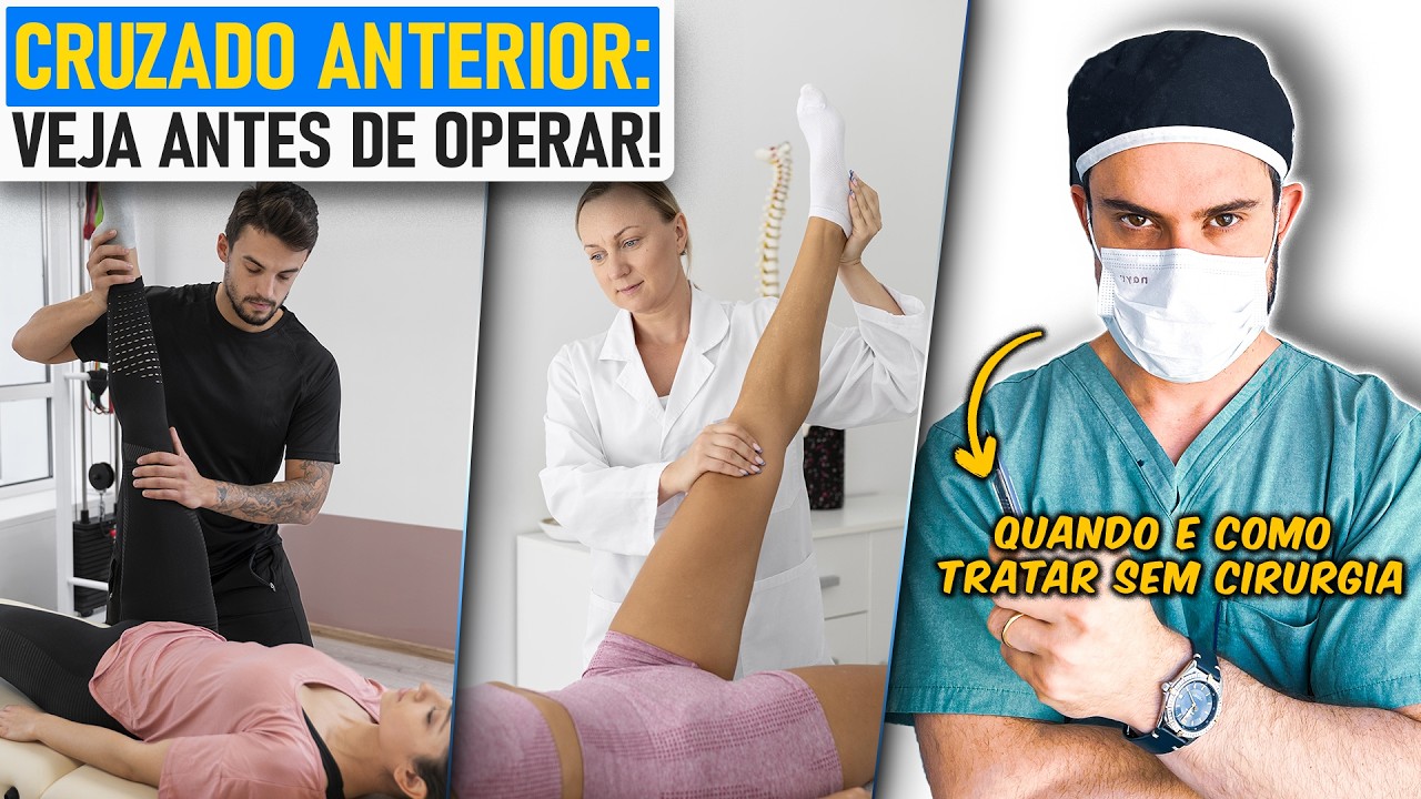 Ligamento Cruzado Anterior: Como Tratar SEM Cirurgia? Guia Definitivo c/ Ortopedista [LCA]