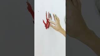 Download lagu Stem Cell Theraphy || Advantages for cerebral palsy || Webinar mp3 Download lagu Stem Cell Theraphy || Advantages for cerebral palsy || Webinar mp3