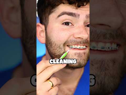 Best Way to Clean Braces !?