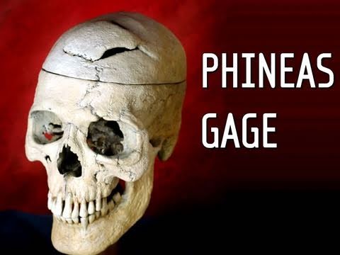 Phineas Gage - Hank Green
