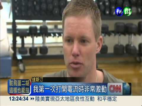 電極片 電刺激癱瘓竟能走