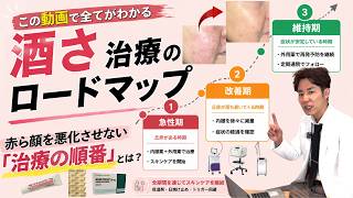 酒さ治療ロードマップ｜赤み・ブツブツの保険診療・自費・レーザーを皮膚科専門医が徹底解説