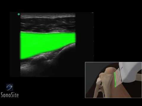 Profilo trattare osteocondrosi Pomata per la schiena ernia dolore
