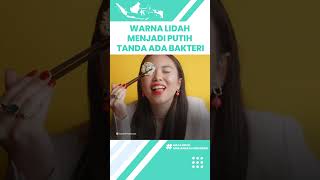 Waspadai Lidah yang Berubah Warna Jadi Putih Bisa Jadi Tanda Adanya Bakteri, Kenali Gejalanya
