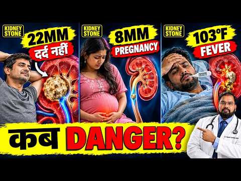 Kidney Stone Emergency | Pregnancy, Fever, 22mm Stone