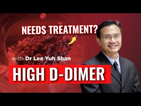 HIGH D-DIMER ‼️ NEED TO BE TREATED? BY DR LEE YUH SHAN