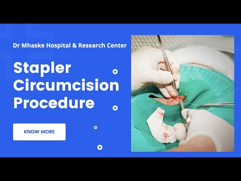 Stapler Circumcision Procedure - Dr. Chetan Mhaske