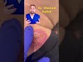 Infected abscess explained #skincare dr khaled sadek