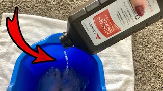 Put Hydrogen Peroxide on your FEET & SEE WHAT HAPPENS! 💥 (this is cool and surprising)