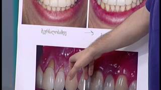 ექიმები - აცრა, კბილების მოვლა - 26.04.2015