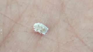 Aphid on my hand aka ant's cow