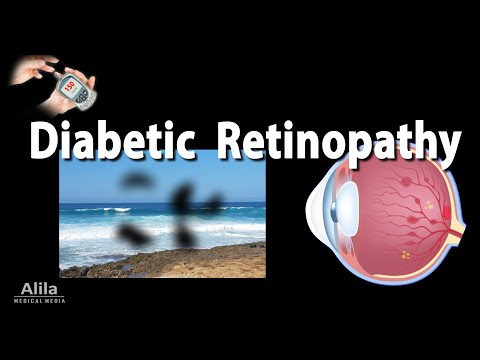 Retinopathy: Diabetic and Hypertensive, Animation.