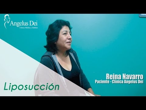 Liposucción – Clínica Angelus Dei