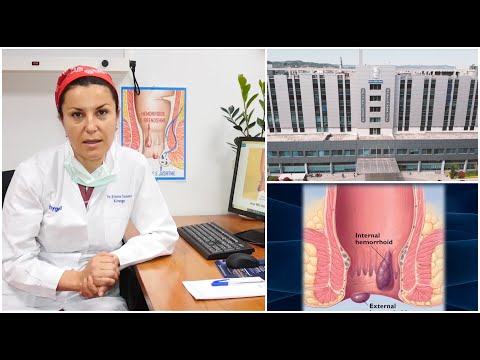 Problemet e zorres se trashe,mjeket ne “Hygeia” thirrje pacienteve qe te konsultohen me specialistet