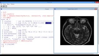 6.4.7 R6. Segmenting Images - Video 5: K-Means Clustering