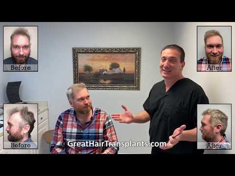 Dr. Brett Bolton patient Ryan MaxHarvest plus procedure




