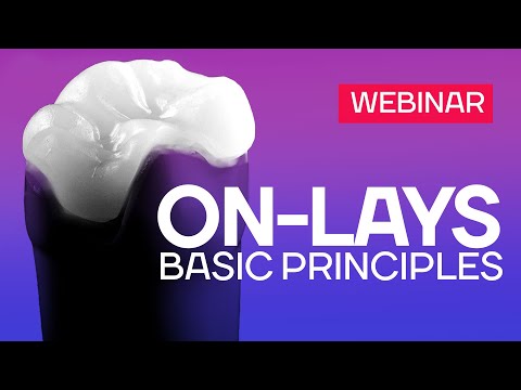 Onlays - Basic Principles - Webinar