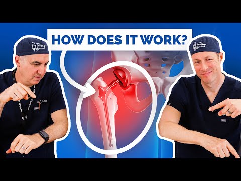 What Really Happens During Hip Replacement Surgery
