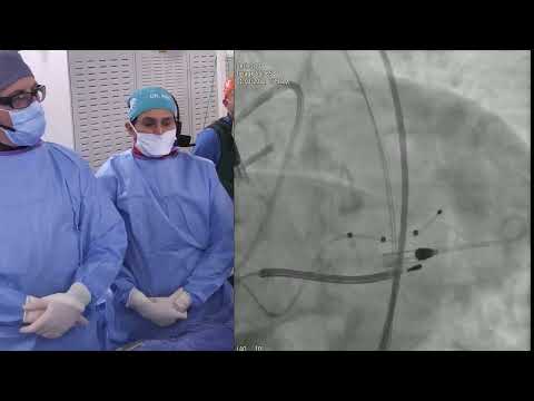 GIS Live - 11.3.2022