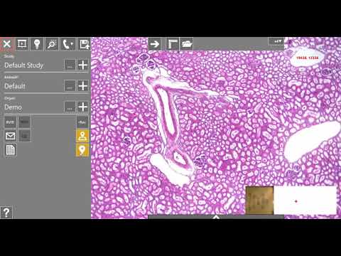 microscope slide tracking demo via Augmentiqs logo