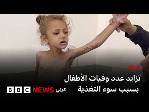 فيديو | الأمم المتحدة تطالب بإجراءات عاجلة مع الإعلان عن تزايد عدد وفيات الأطفال