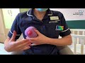 How To Hand Express Breast Milk Infant Feeding Team